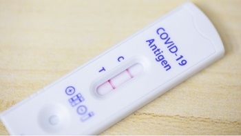 Test positivo Covid